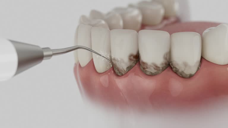 Reliable Dental Implants contractor in Meadowood, PA by Smile Center Dentistry